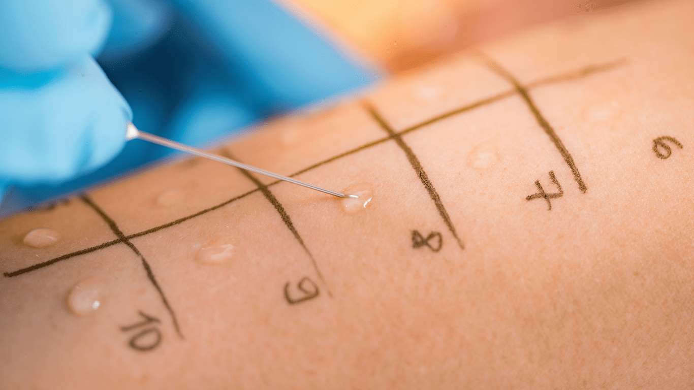 Wie erkenne ich eine Milbenallergie? Diagnostik und Tests